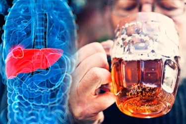 Treatment of Alcoholic Liver Disease in Bhiwani, Best Liver Specialist, Dr Mayank Chugh Best Gastroeneterologist in Bhiwani, Liver Damage Treatment